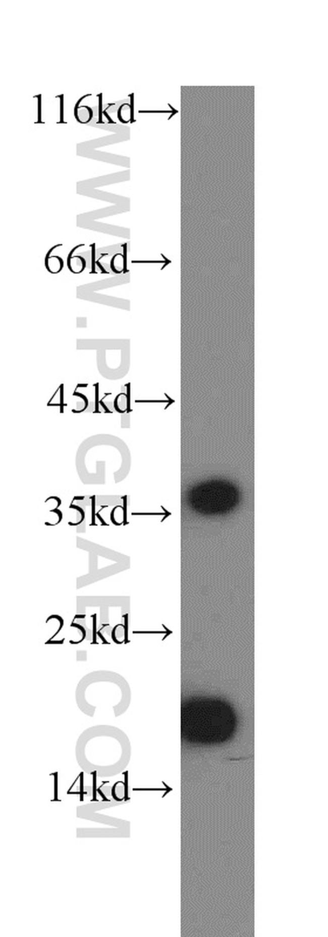 ARF5 Antibody in Western Blot (WB)