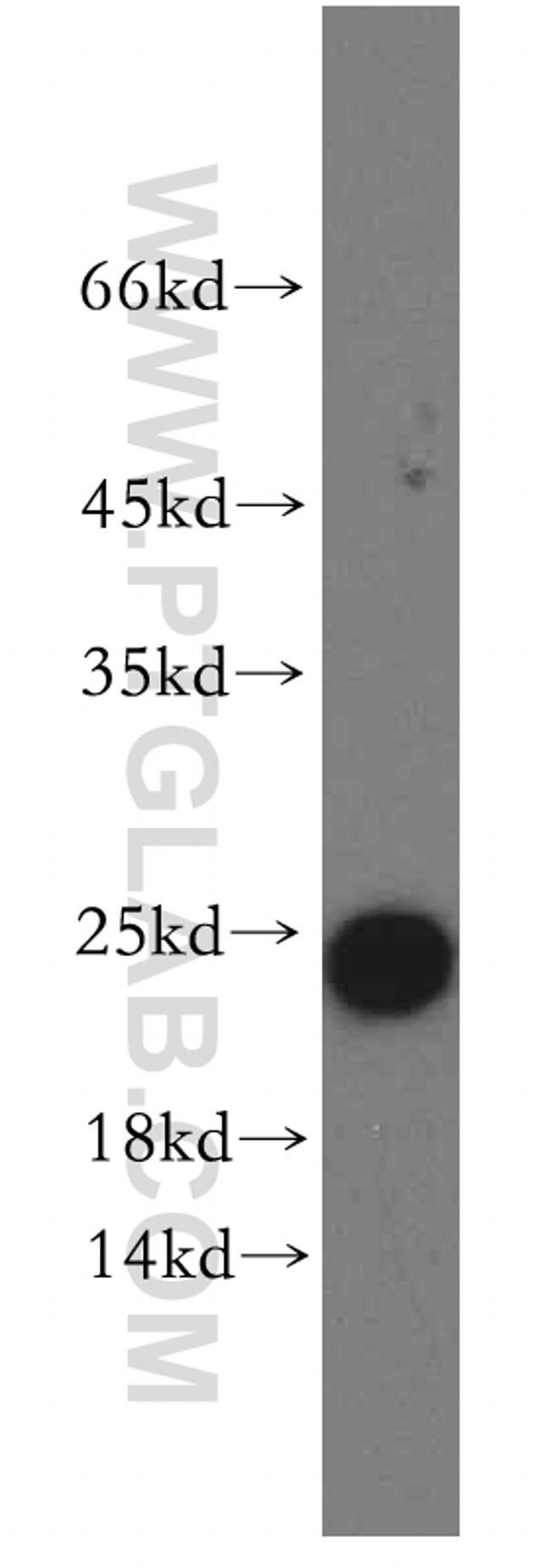 ARF5 Antibody in Western Blot (WB)