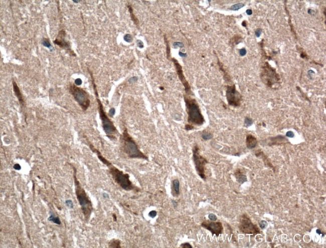 RAB5A Antibody in Immunohistochemistry (Paraffin) (IHC (P))