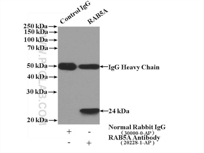 RAB5A Antibody in Immunoprecipitation (IP)