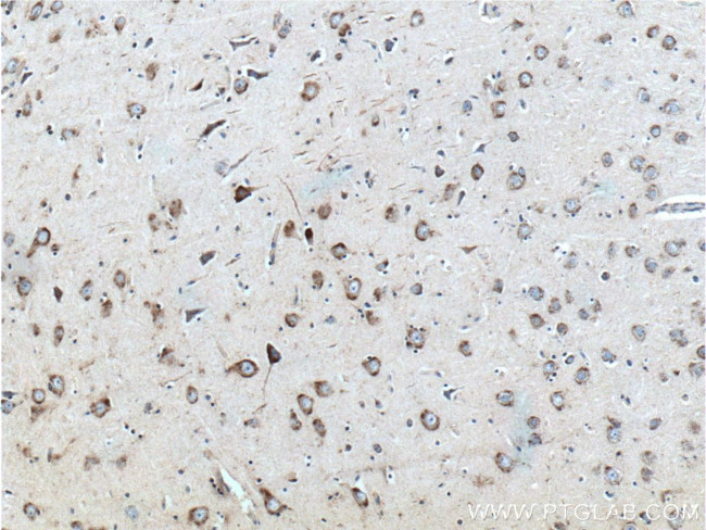 RAB5A Antibody in Immunohistochemistry (Paraffin) (IHC (P))