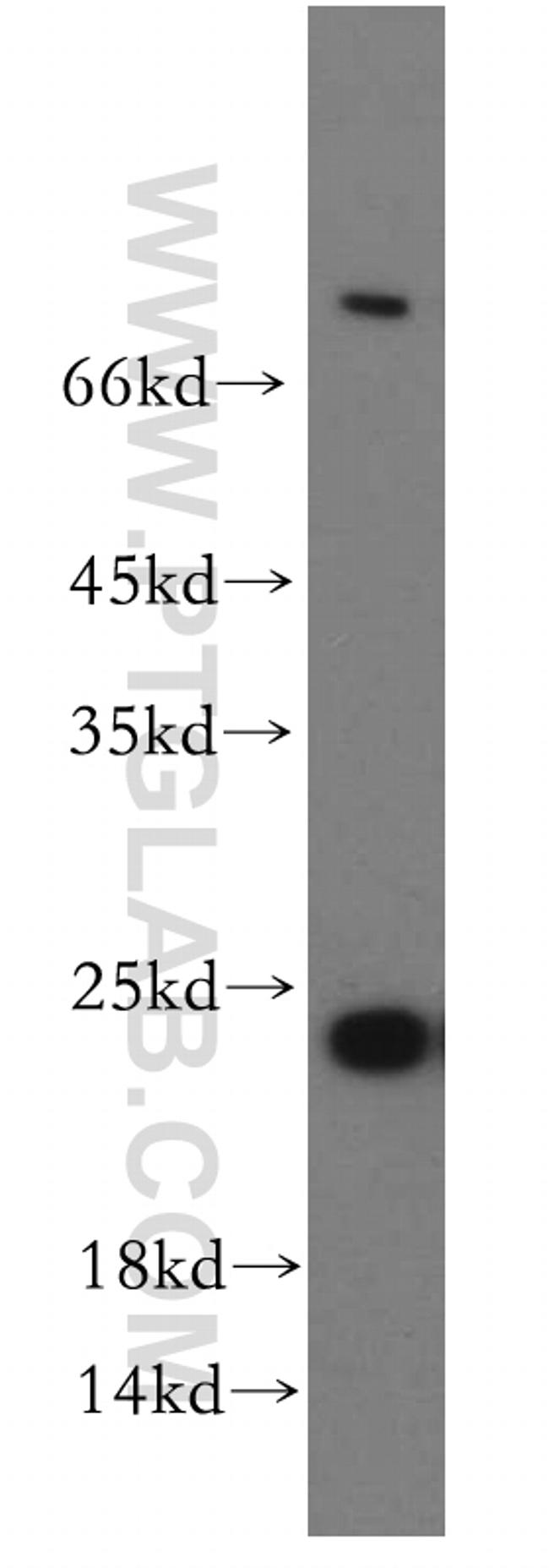 RAB5A Antibody in Western Blot (WB)