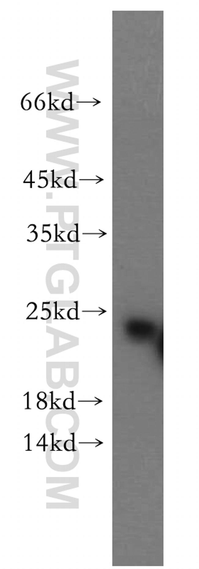 RAB5A Antibody in Western Blot (WB)