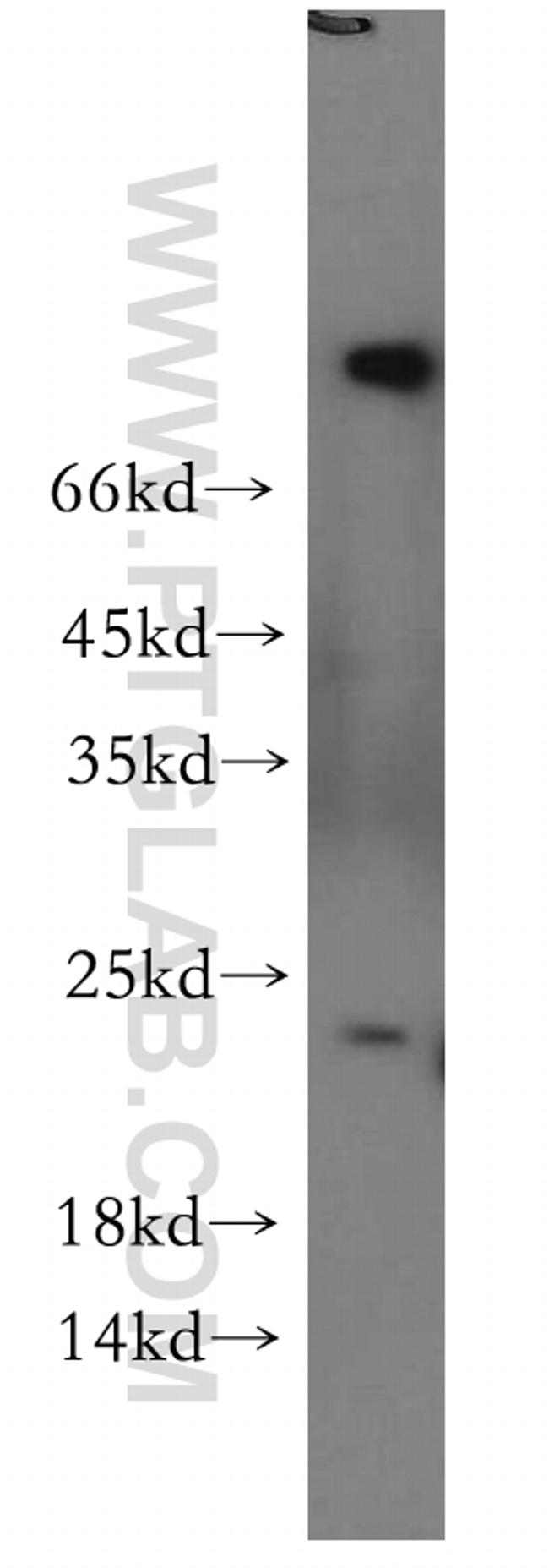 RAB5A Antibody in Western Blot (WB)