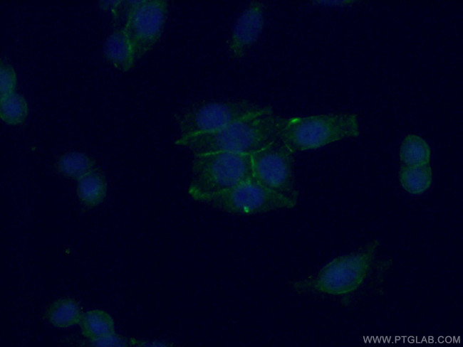 RAB11A Antibody in Immunocytochemistry (ICC/IF)