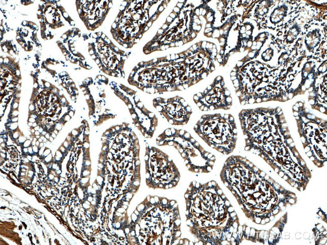 RAB11A Antibody in Immunohistochemistry (Paraffin) (IHC (P))