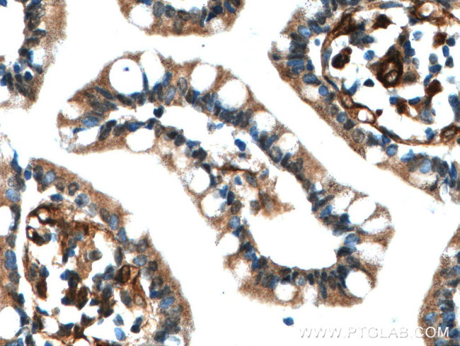 RAB11A Antibody in Immunohistochemistry (Paraffin) (IHC (P))