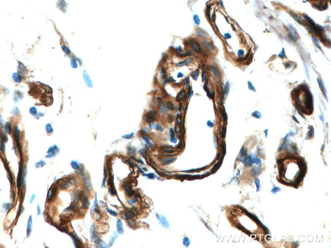 RAB11A Antibody in Immunohistochemistry (Paraffin) (IHC (P))