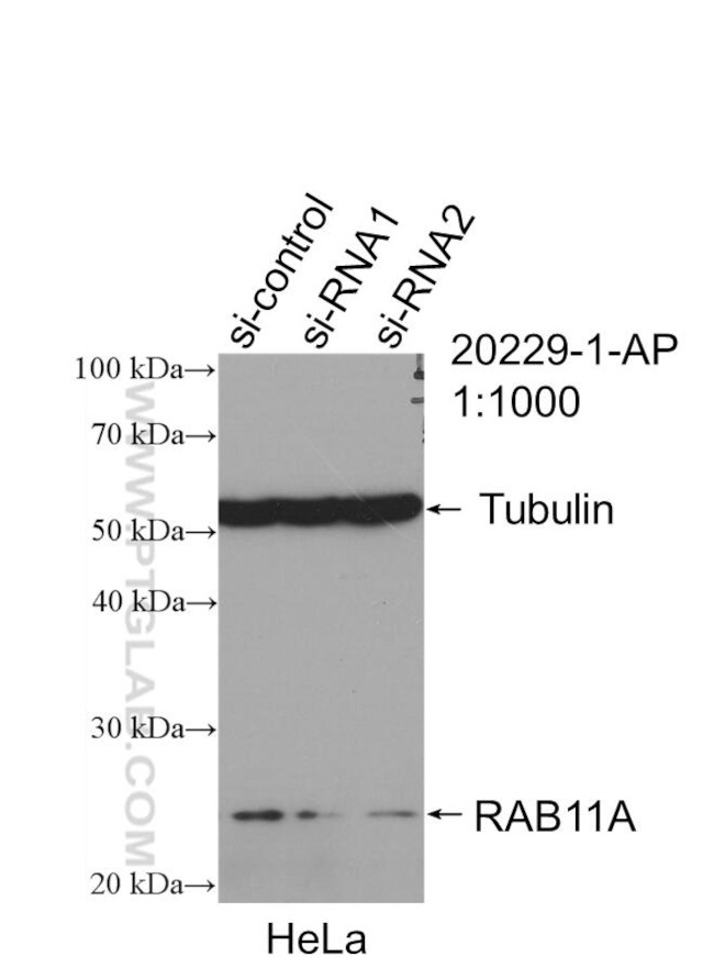 RAB11A Antibody in Western Blot (WB)