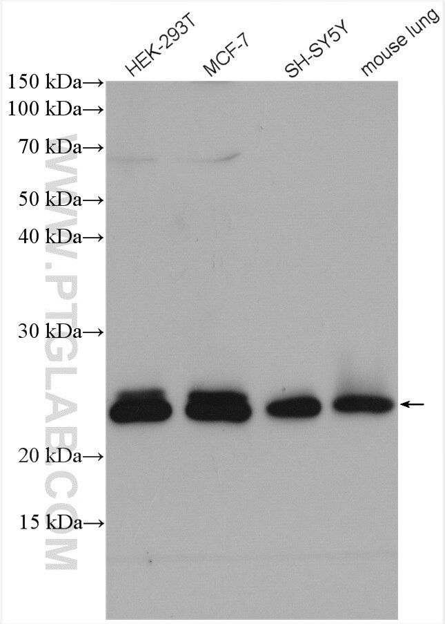 RAB11A Antibody in Western Blot (WB)