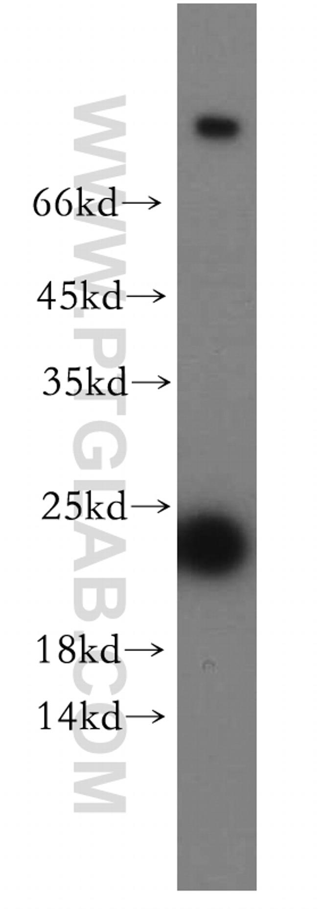 RAB11A Antibody in Western Blot (WB)