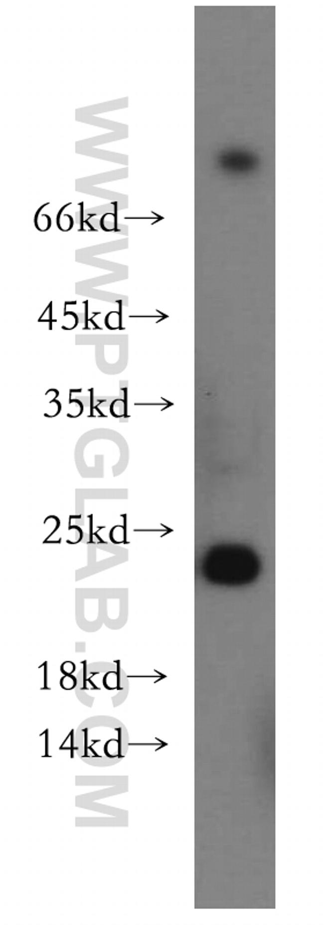 RAB11A Antibody in Western Blot (WB)