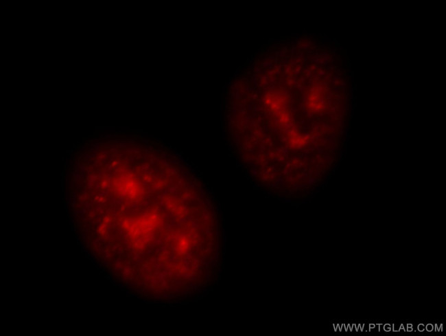 TOP2A Antibody in Immunocytochemistry (ICC/IF)