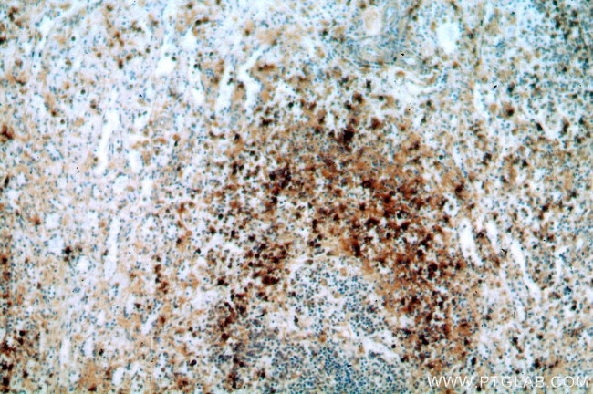 TOP2A Antibody in Immunohistochemistry (Paraffin) (IHC (P))