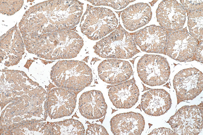 TOP2A Antibody in Immunohistochemistry (Paraffin) (IHC (P))