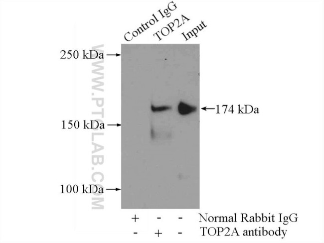 TOP2A Antibody in Immunoprecipitation (IP)