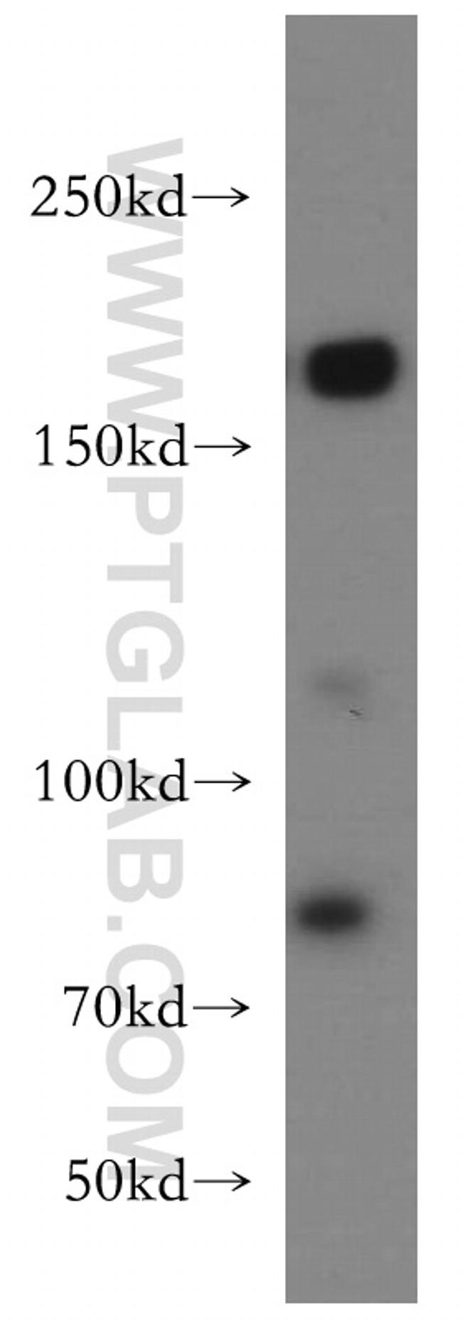 TOP2A Antibody in Western Blot (WB)