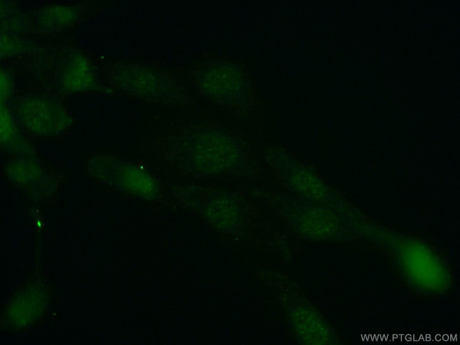 CSNK2B Antibody in Immunocytochemistry (ICC/IF)