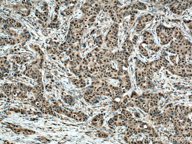 CSNK2B Antibody in Immunohistochemistry (Paraffin) (IHC (P))