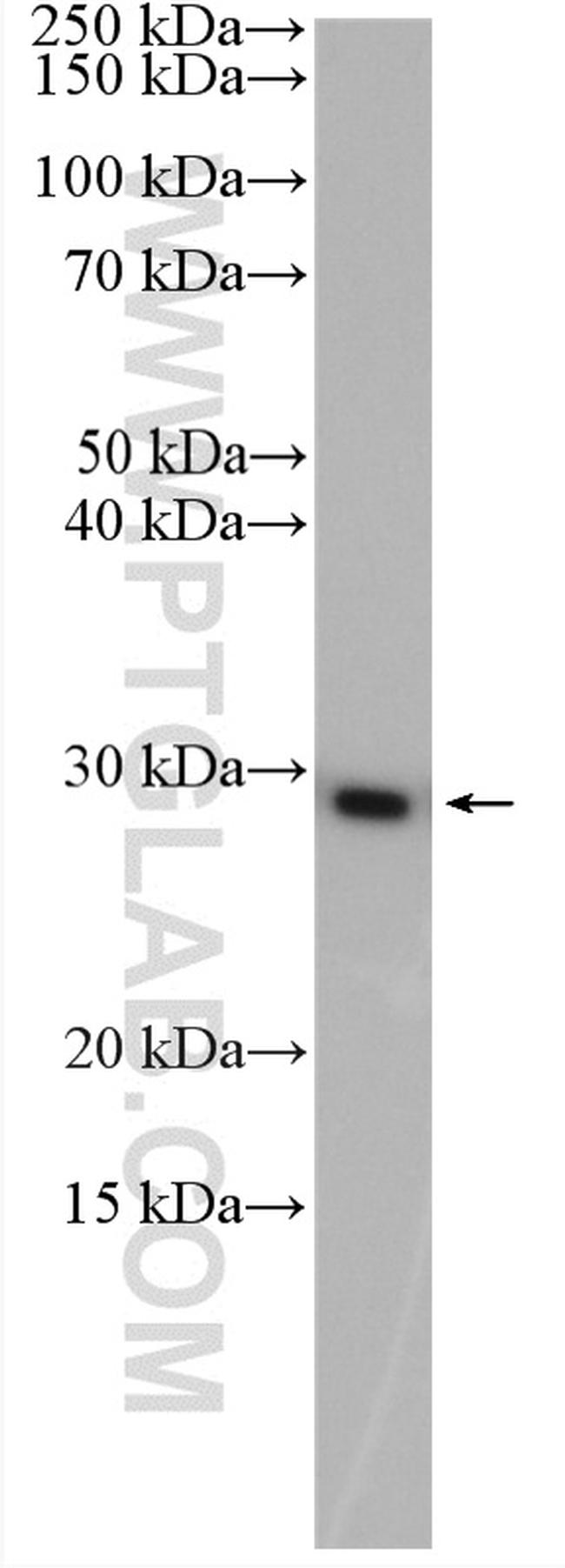 CSNK2B Antibody in Western Blot (WB)