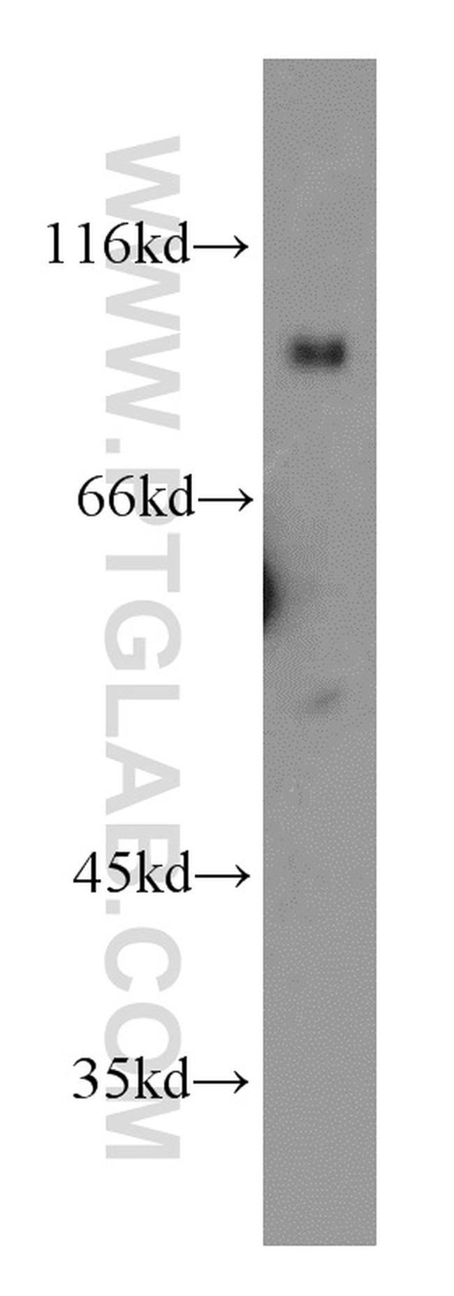 UNC5A Antibody in Western Blot (WB)