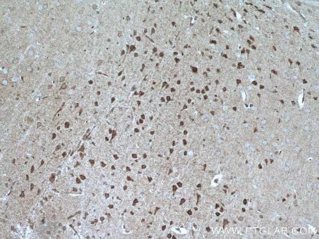 UNC5C Antibody in Immunohistochemistry (Paraffin) (IHC (P))