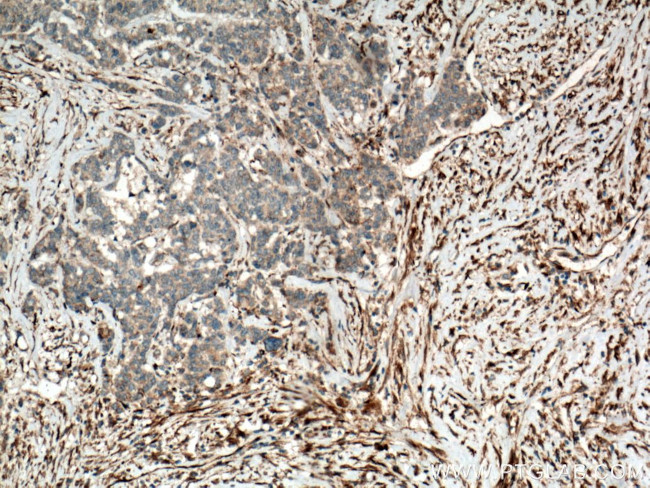 YES1 Antibody in Immunohistochemistry (Paraffin) (IHC (P))