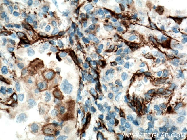 YES1 Antibody in Immunohistochemistry (Paraffin) (IHC (P))