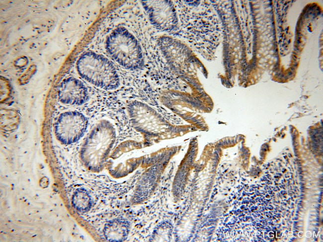 YES1 Antibody in Immunohistochemistry (Paraffin) (IHC (P))