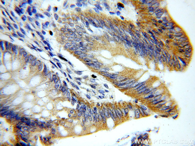 YES1 Antibody in Immunohistochemistry (Paraffin) (IHC (P))