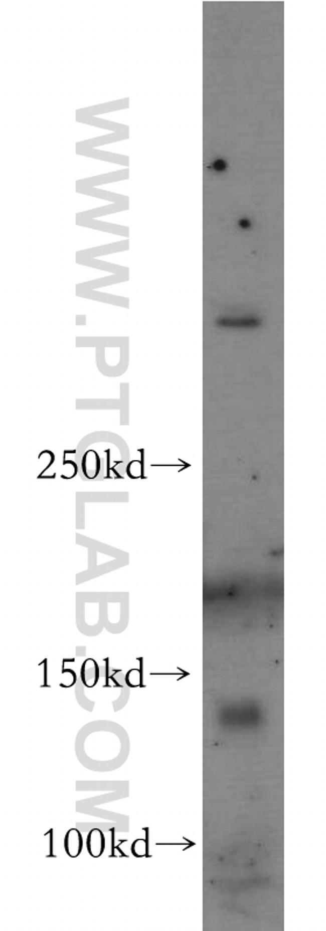 Neogenin Antibody in Western Blot (WB)