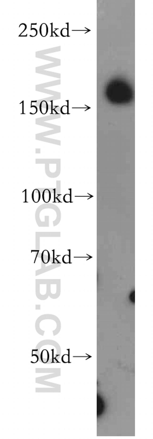 Neogenin Antibody in Western Blot (WB)