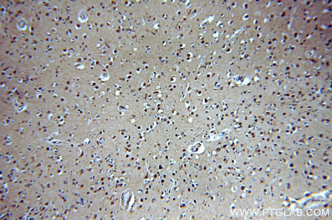 ROCK2(C-term) Antibody in Immunohistochemistry (Paraffin) (IHC (P))