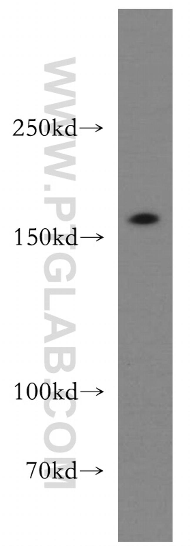 ROCK2(C-term) Antibody in Western Blot (WB)