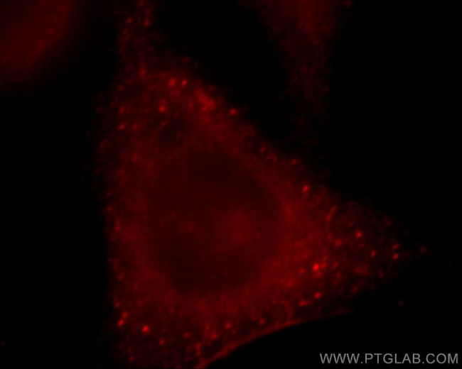 ROCK2(C-term) Antibody in Immunocytochemistry (ICC/IF)