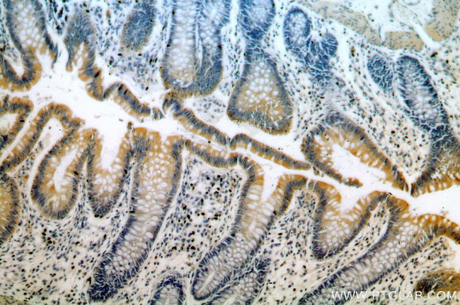 ROCK2(C-term) Antibody in Immunohistochemistry (Paraffin) (IHC (P))