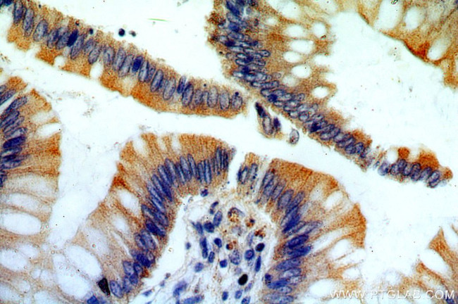 ROCK2(C-term) Antibody in Immunohistochemistry (Paraffin) (IHC (P))