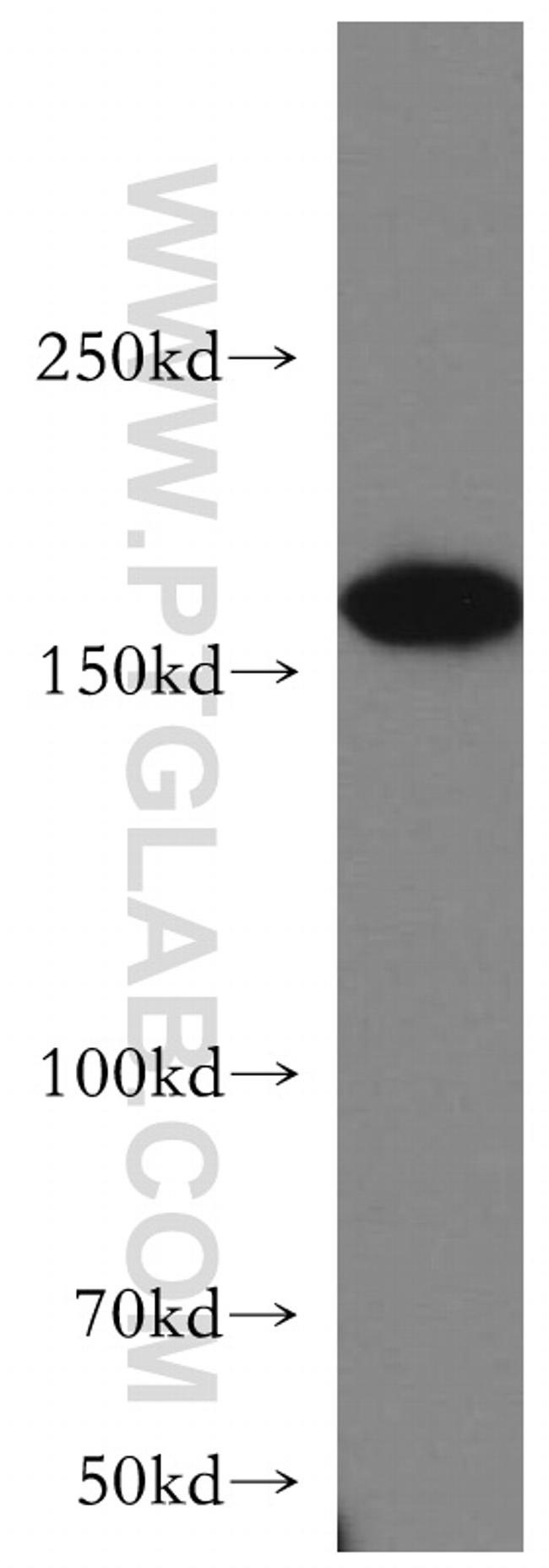 ROCK2(C-term) Antibody in Western Blot (WB)