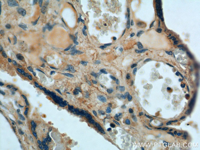 fibrillin 2 Antibody in Immunohistochemistry (Paraffin) (IHC (P))