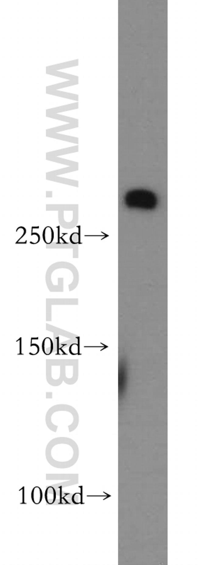 fibrillin 2 Antibody in Western Blot (WB)