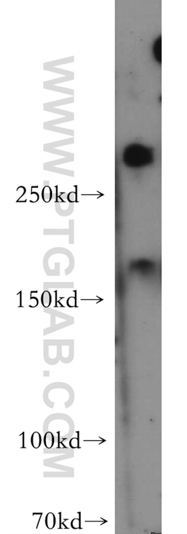 fibrillin 2 Antibody in Western Blot (WB)