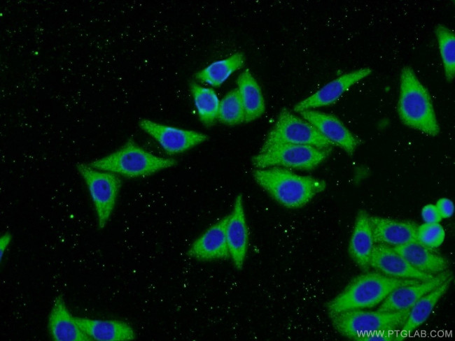 IGF2R Antibody in Immunocytochemistry (ICC/IF)