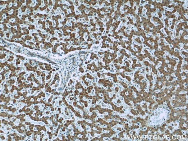 IGF2R Antibody in Immunohistochemistry (Paraffin) (IHC (P))