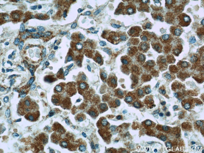 IGF2R Antibody in Immunohistochemistry (Paraffin) (IHC (P))