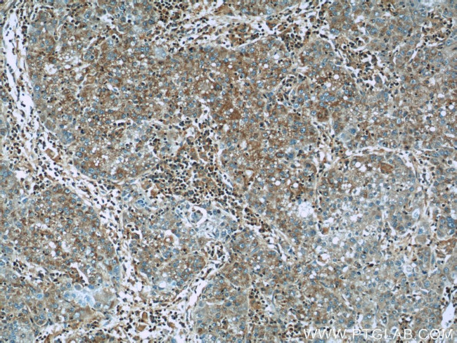 IGF2R Antibody in Immunohistochemistry (Paraffin) (IHC (P))