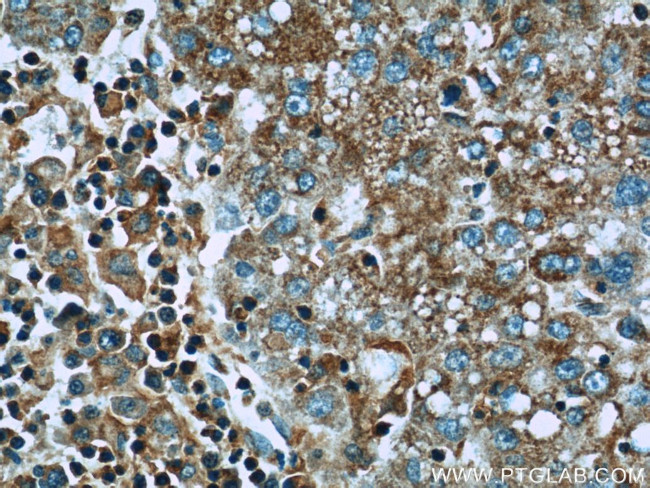 IGF2R Antibody in Immunohistochemistry (Paraffin) (IHC (P))