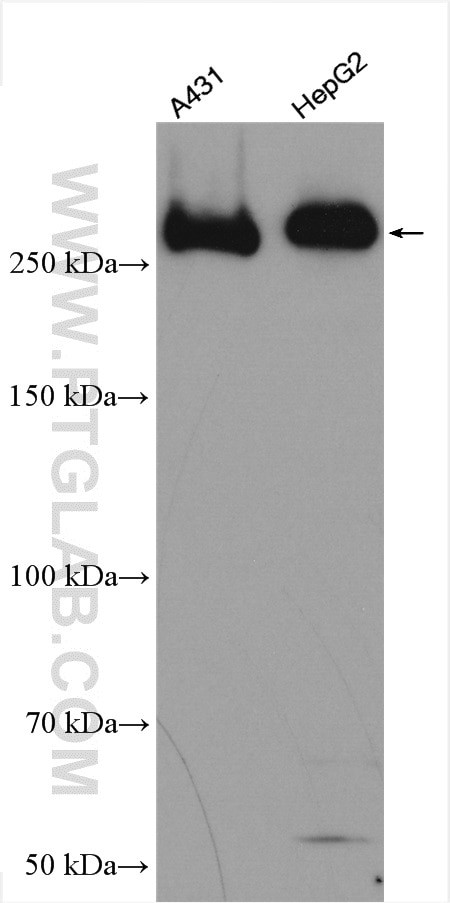 IGF2R Antibody in Western Blot (WB)