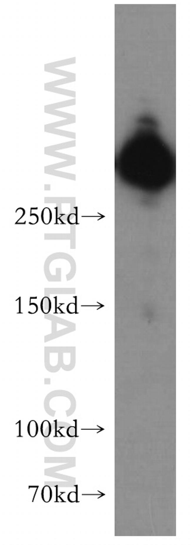 IGF2R Antibody in Western Blot (WB)