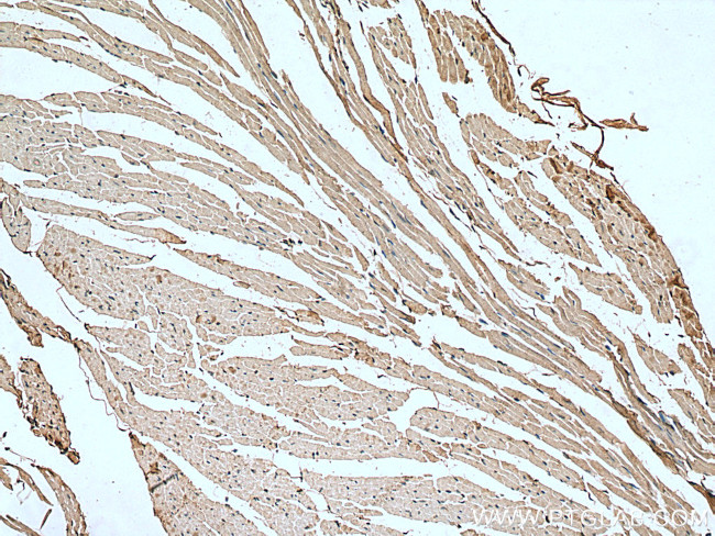 SCN7A Antibody in Immunohistochemistry (Paraffin) (IHC (P))