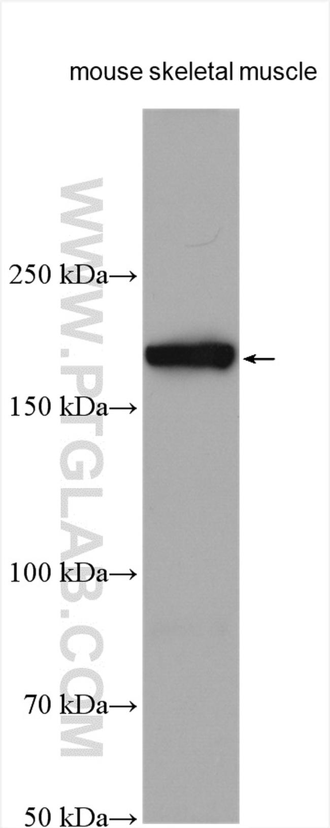 SCN7A Antibody in Western Blot (WB)